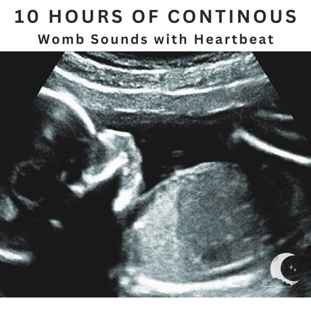 10 Hours Continuous WOMB Sounds With Heartbeat - White Noise Radiance